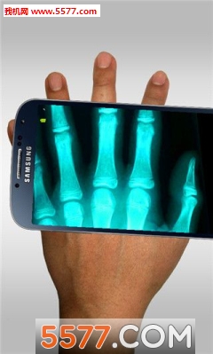 Xray Scanner Prank(ֻxɨǰ׿)ͼ1