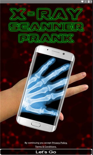 xray scanner prank(ֻxƬapp)