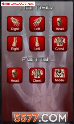 X-ray Scan(Xɨ)ͼ1