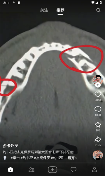 �������������ͼ1